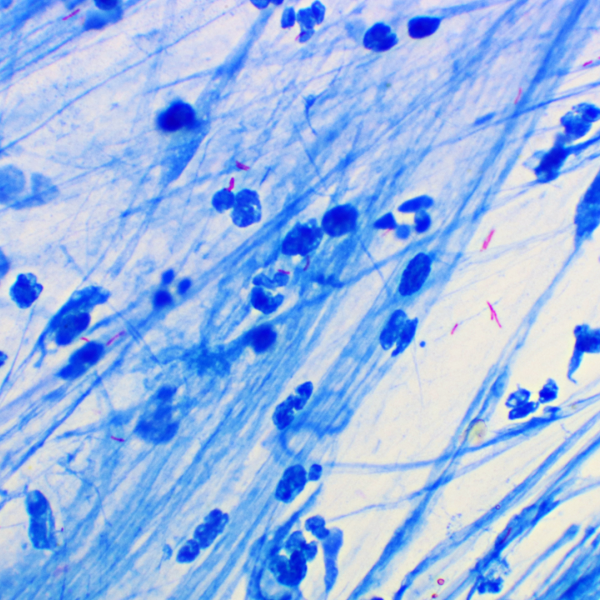 A color photo of Mycobacterium tuberculosis Credit: Shutterstock contributor Jarun Ontakrai